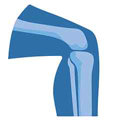 صحة المفاصل والعظام