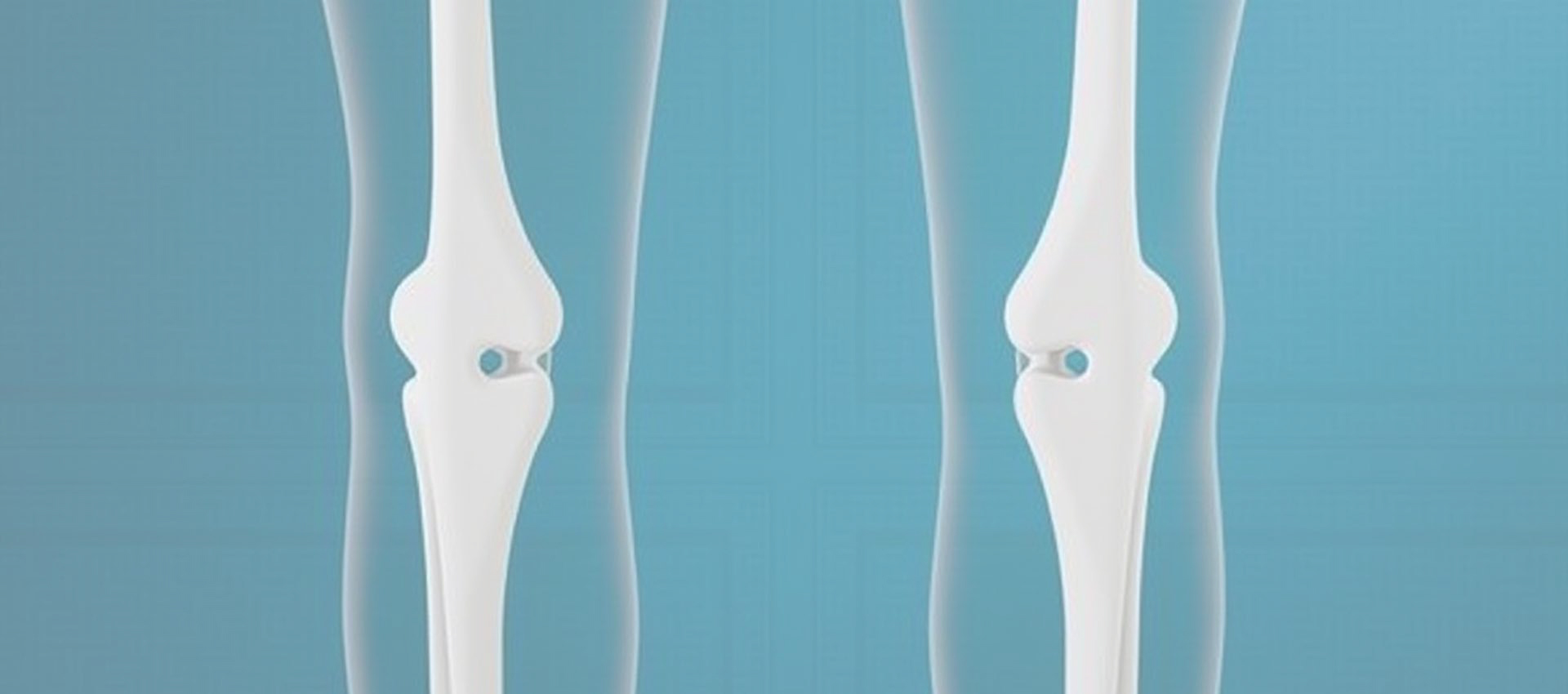 فيتامين د 3 الشحومي