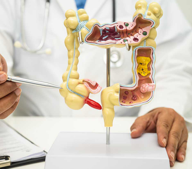 مثالية للصحة الأيضية والجهاز الهضمي