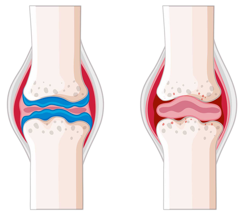 يعزز صحة العظام والقلب والأوعية الدموية